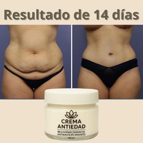 OFERTA LIMITADA: Compra 1 y llévate  — Crema Rejuvenecedora con Colágeno | Pago contra entrega